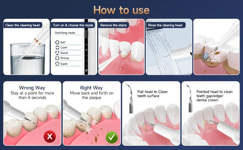 Ultrasonic Dog Dental Cleaner – Electric Toothbrush & Plaque Remover for Pet Teeth